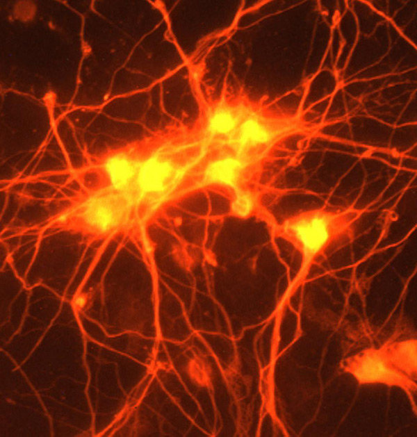 Kopplingar mellan nervceller i hjärnan heter synapser.